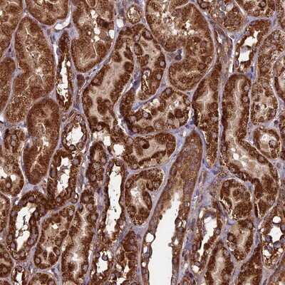 Immunohistochemistry-Paraffin: CCDC8 Antibody [NBP1-85085]