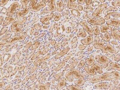 Immunohistochemistry-Paraffin: CCDC8 Antibody [NBP3-06010]