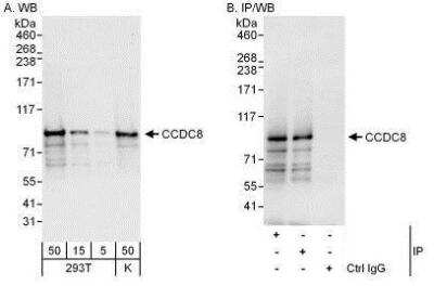 Western Blot: CCDC8 Antibody [NBP1-50021]