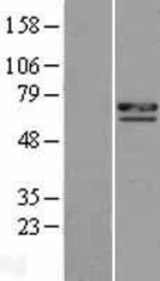 Western Blot: CCDC8 Overexpression Lysate [NBL1-08824]