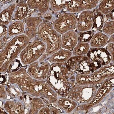 Immunohistochemistry-Paraffin: CCDC81 Antibody [NBP1-91763]