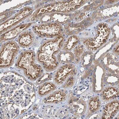 Immunohistochemistry-Paraffin: CCDC81 Antibody [NBP1-91764]