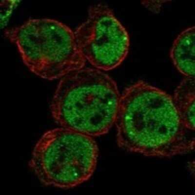 Immunocytochemistry/ Immunofluorescence: CCDC82 Antibody [NBP3-17223]