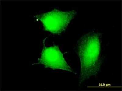 Immunocytochemistry/ Immunofluorescence: CCDC83 Antibody (3E3) [H00220047-M01]