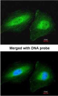 Immunocytochemistry/ Immunofluorescence: CCDC83 Antibody [NBP1-32738]