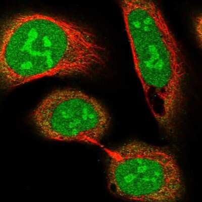 Immunocytochemistry/ Immunofluorescence: CCDC86 Antibody [NBP1-93500]