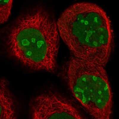 Immunocytochemistry/ Immunofluorescence: CCDC86 Antibody [NBP1-93501]
