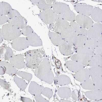 Immunohistochemistry-Paraffin: CCDC88B Antibody [NBP1-88350]