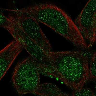 Immunocytochemistry/ Immunofluorescence: CCDC89 Antibody [NBP2-57795]