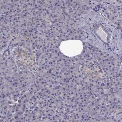 Immunohistochemistry-Paraffin: CCDC89 Antibody [NBP2-57795]