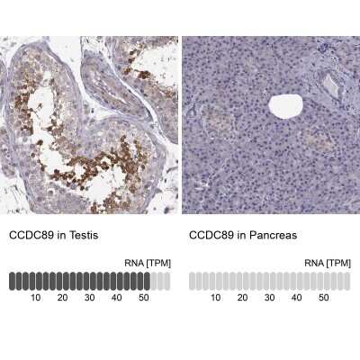 Immunohistochemistry-Paraffin: CCDC89 Antibody [NBP2-57795]