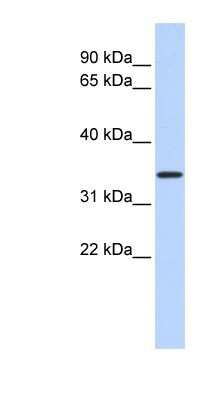 Western Blot: CCDC90A Antibody [NBP1-91586]