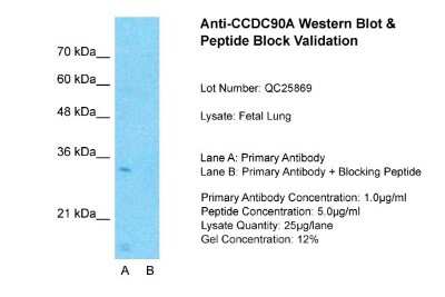 Western Blot: CCDC90A Antibody [NBP1-91586]