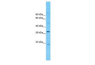 Western Blot: CCDC90A Antibody [NBP1-91586]