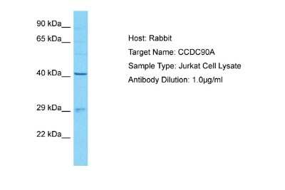 Western Blot: CCDC90A Antibody [NBP1-91586]