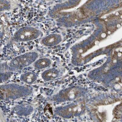 Immunohistochemistry-Paraffin: CCDC90B Antibody [NBP1-93528]