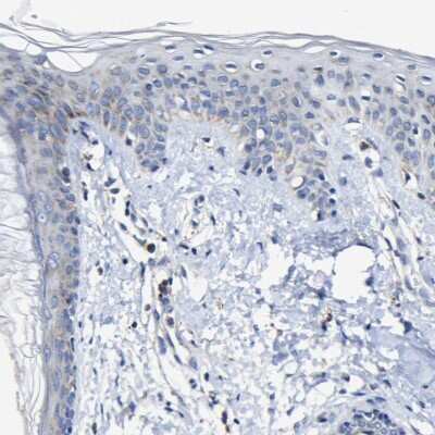 Immunohistochemistry-Paraffin: CCDC90B Antibody [NBP1-93529]
