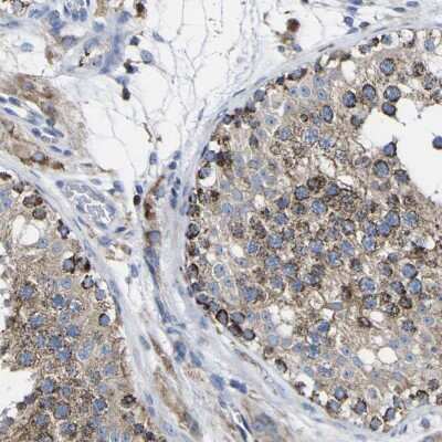 Immunohistochemistry-Paraffin: CCDC90B Antibody [NBP1-93529]