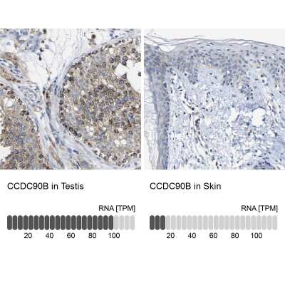 Immunohistochemistry-Paraffin: CCDC90B Antibody [NBP1-93529]