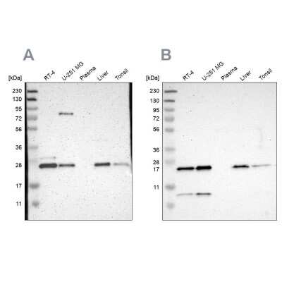 Western Blot: CCDC90B Antibody [NBP1-93528]