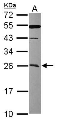 Western Blot: CCDC90B Antibody [NBP2-15756]