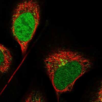 Immunocytochemistry/ Immunofluorescence: CCDC91 Antibody [NBP1-84084]