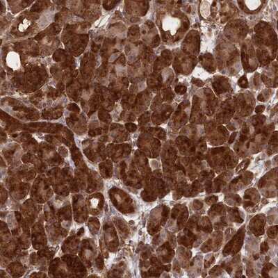 Immunohistochemistry-Paraffin: CCDC91 Antibody [NBP1-84084]