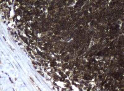 Immunohistochemistry: CCDC93 Antibody (OTI6E11) [NBP2-45588]