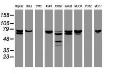 Western Blot: CCDC93 Antibody (OTI6E11) [NBP2-45588]