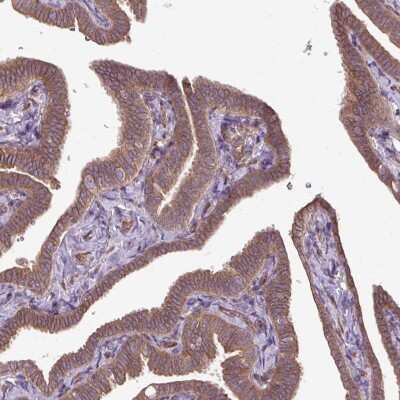 Immunohistochemistry-Paraffin: CCDC93 Antibody [NBP2-30369]
