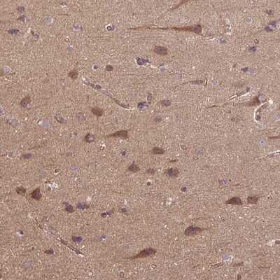 Immunohistochemistry-Paraffin: CCDC93 Antibody [NBP2-30369]