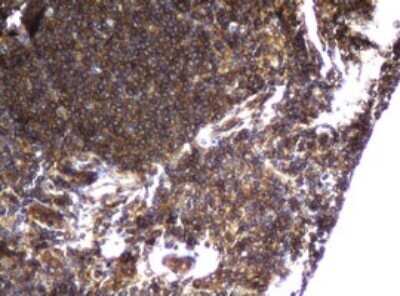 Immunohistochemistry: CCDC93 Antibody (OTI6E11) - Azide and BSA Free [NBP2-71963]