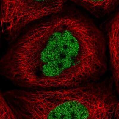 Immunocytochemistry/ Immunofluorescence: CCDC94 Antibody [NBP2-55866]