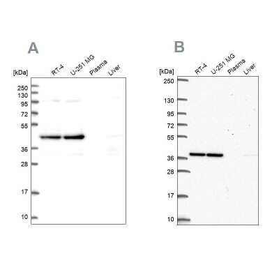 Western Blot: CCDC94 Antibody [NBP1-91766]