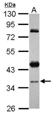 Western Blot: CCDC94 Antibody [NBP2-15757]