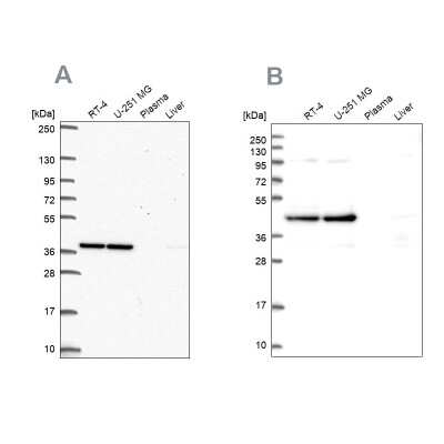 Western Blot: CCDC94 Antibody [NBP2-55866]