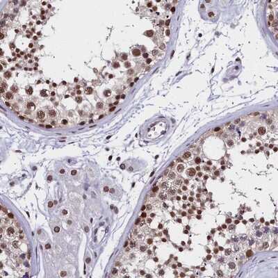 Immunohistochemistry-Paraffin: CCDC97 Antibody [NBP1-91767]
