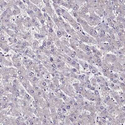 Immunohistochemistry-Paraffin: CCDC97 Antibody [NBP1-91767]