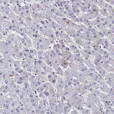 Immunohistochemistry-Paraffin: CCDC97 Antibody [NBP1-91768]