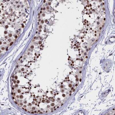 Immunohistochemistry-Paraffin: CCDC97 Antibody [NBP1-91768]