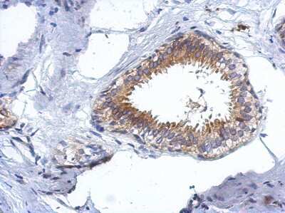 Immunohistochemistry-Paraffin: CCDC97 Antibody [NBP2-15758]