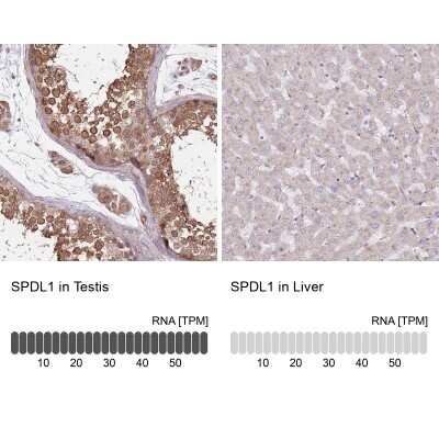 Immunohistochemistry-Paraffin: CCDC99 Antibody [NBP2-47518]