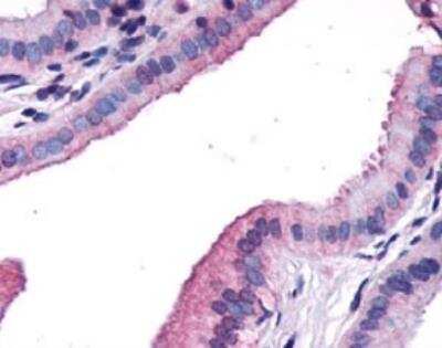 Immunohistochemistry-Paraffin: CCK-AR Antibody - BSA Free [NLS3293]