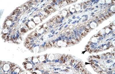 Immunohistochemistry-Paraffin: CCL18/PARC Antibody [NBP1-79940]