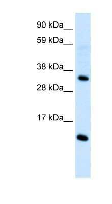 Western Blot: CCL18/PARC Antibody [NBP1-79940]