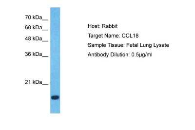 Western Blot: CCL18/PARC Antibody [NBP1-79940]