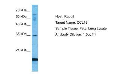 Western Blot: CCL18/PARC Antibody [NBP1-79940]