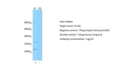 Western Blot: CCL18/PARC Antibody [NBP1-79940]