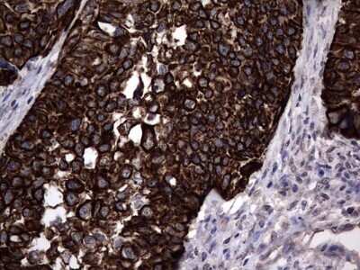 Immunohistochemistry: CCL19/MIP-3 beta Antibody (OTI2A12) [NBP2-46082]