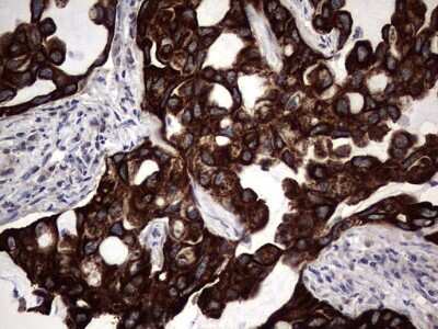 Immunohistochemistry: CCL19/MIP-3 beta Antibody (OTI2A12) [NBP2-46082]